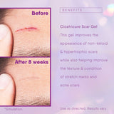 Cicatricure Advanced Scar Gel for Face & Body, 28g