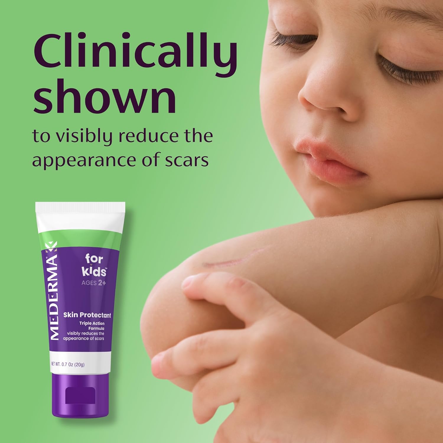 Mederma for Kids Skin Care for Scars, 20g